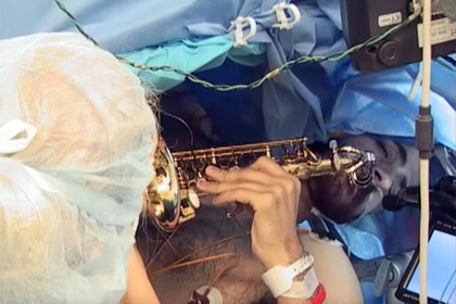 У музыканта удалили опухоль мозга во время игры на саксофоне