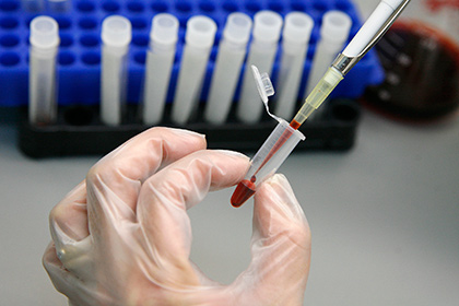 Препарат на основе антител к ВИЧ впервые успешно испытали на людях
