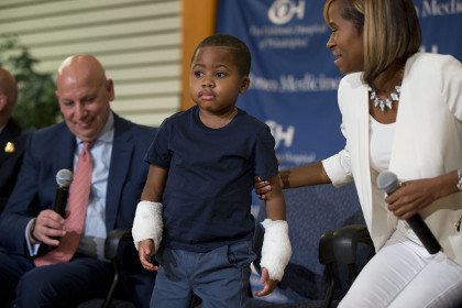 Врачи в США пересадили кисти рук восьмилетнему мальчику