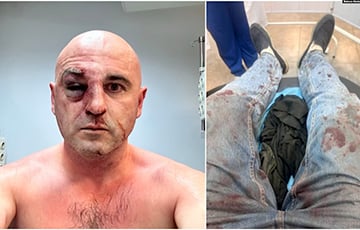 В Тбилиси жестоко избили лидеров оппозиции