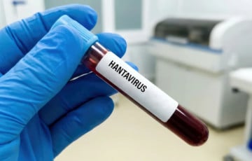Минздрав, комментируя информацию о хантвирусе, рассказал о хомяках
