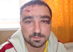 Суд отправил на пересмотр дело избитого милицией жителя Дзержинска