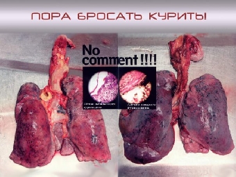 Каждый курящий белорус лишает себя в среднем 18 лет продолжительности жизни