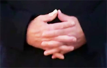 Что у Лукашенко с пальцем на руке?