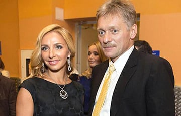 Жена Пескова сделала себе новое лицо