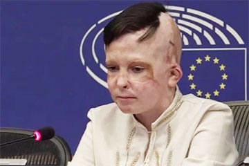 Переводчица Европарламента расплакалась во время рассказа 11-летнего Романа, который выжил во время атаки РФ на Винницу